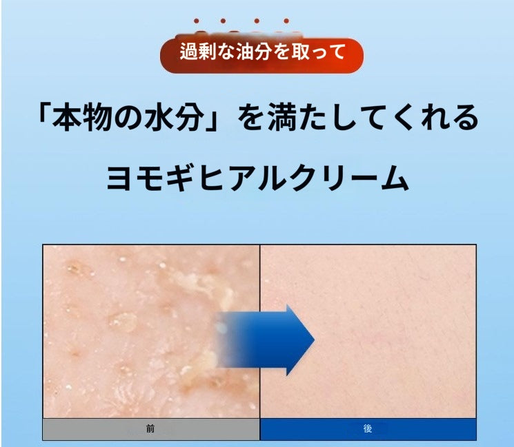 8位 【ハンユル】 ヨモギ ヒアル クリーム 60ml+31ml